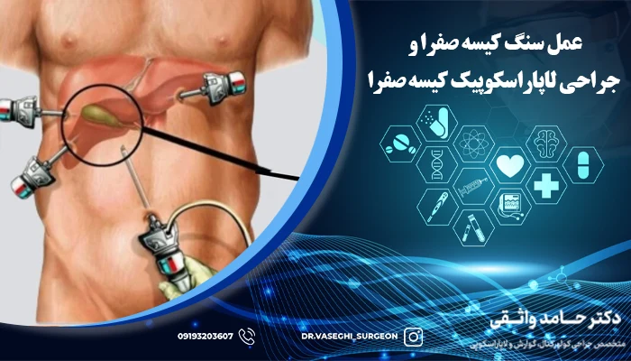 عکس کیسه صفرا پر از سنگ