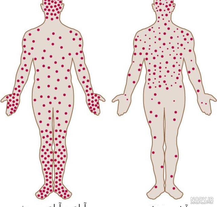عکس از ابله میمونی