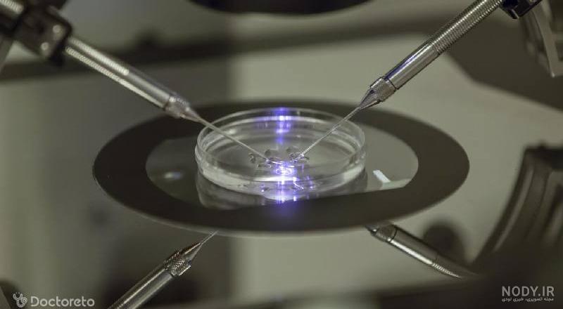آی وی اف چیست؟ (مراحل IVF و مراقبت‌های قبل و بعد از آن)