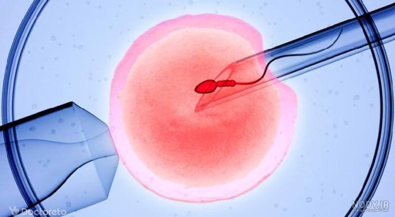 راهی برای به دست آوردن آرزوی شیرین شما/معرفی داروهای ای وی اف (IVF) راهی برای به دست آوردن آرزوی شیرین شما/معرفی داروهای ای وی اف (IVF)