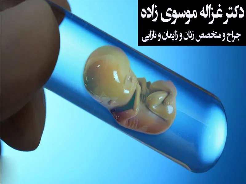 عمل آی وی اف (IVF) چیست؟ آشنایی با مراحل ای وی اف | دکترتو عمل آی وی اف (IVF) چیست؟ آشنایی با مراحل ای وی اف | دکترتو