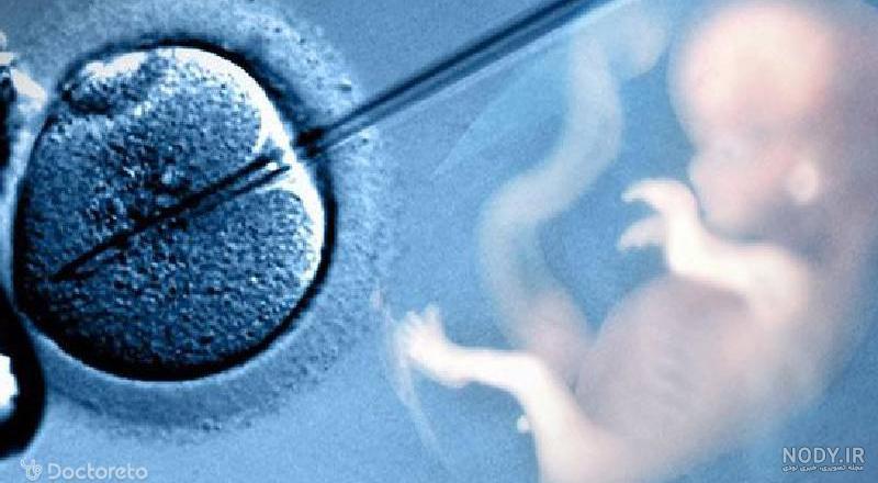 عمل آی وی اف (IVF) چیست؟ آشنایی با مراحل ای وی اف | دکترتو عمل آی وی اف (IVF) چیست؟ آشنایی با مراحل ای وی اف | دکترتو
