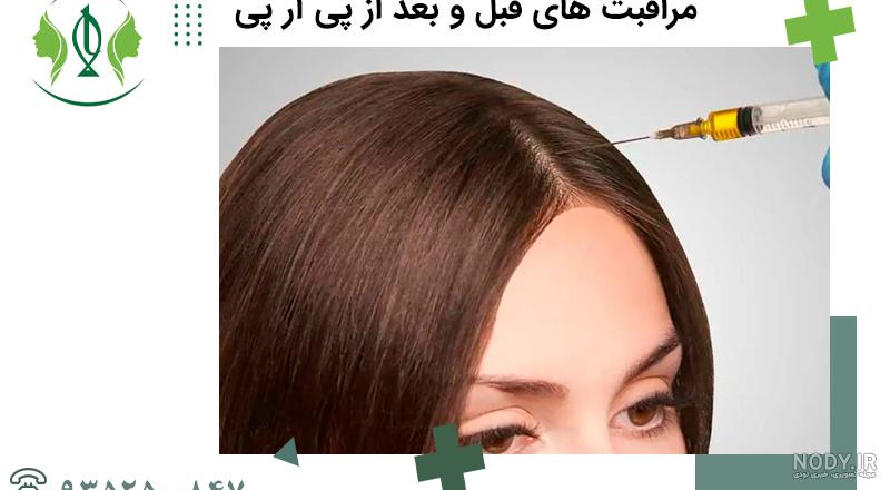 عکس پی آر پی عکس پی آر پی