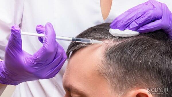 عکس های پی ار پی صورت عکس های پی ار پی صورت
