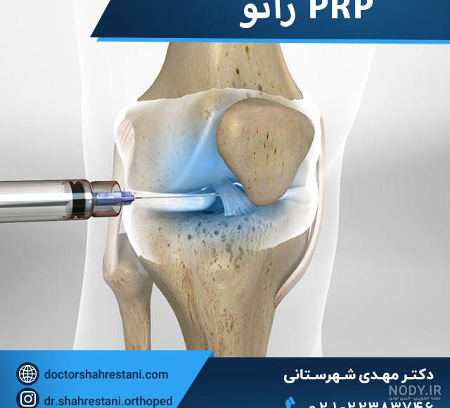 پی آر پی صورت پی آر پی صورت