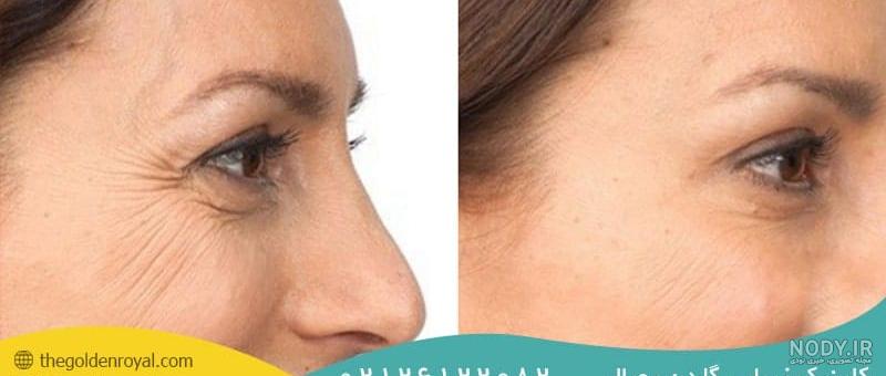پی آر پی چیست؟ بررسی 0 تا 100 آن - کلینیک نوین ایرانا پی آر پی چیست؟ بررسی 0 تا 100 آن - کلینیک نوین ایرانا