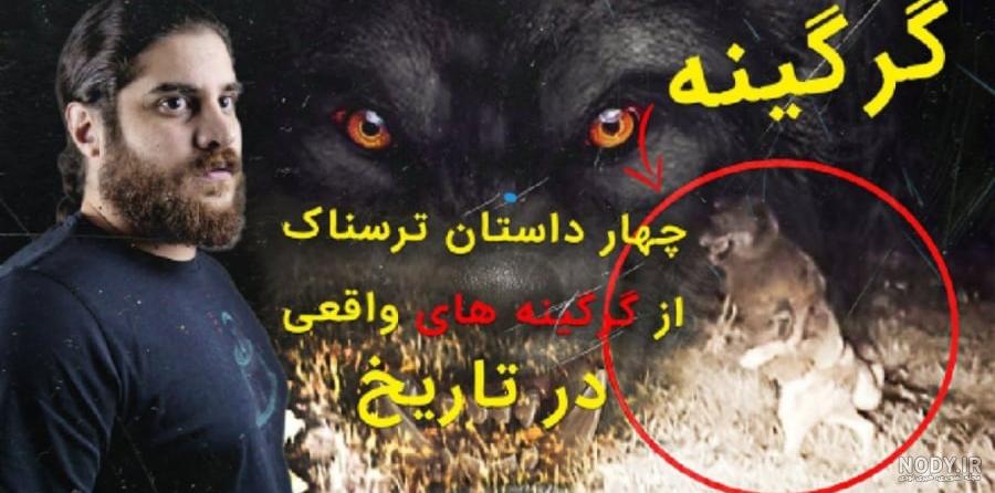 تصاویری از پسر مبتلا به سندروم گرگینه - بهار نیوز