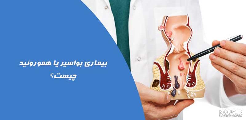 عکس انواع بواسیر خفیف، خارجی بیرون زده، شکل واقعی هموروئید ترومبوزه |  کلینیک اچ پی وی