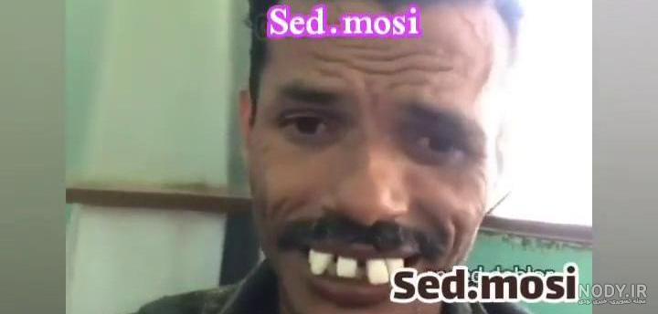 ممد قلی دندان چیست - عکس نودی