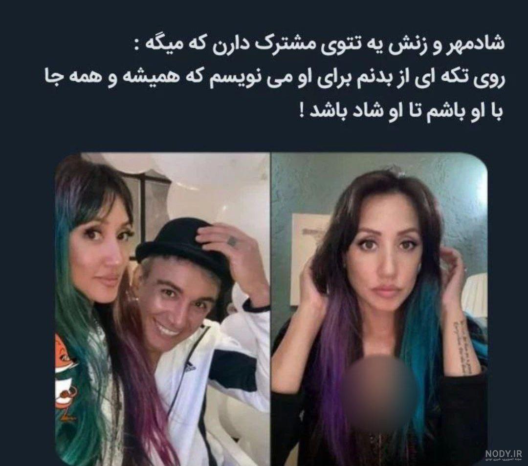 سانسور یکی از خالکوبی‌های امیر تتلو؛ تتوی رو دست تتلو چه بود؟ | خبرفوری |  پلیکان
