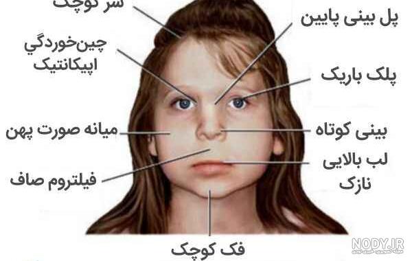 عکس از کودک بیش فعال