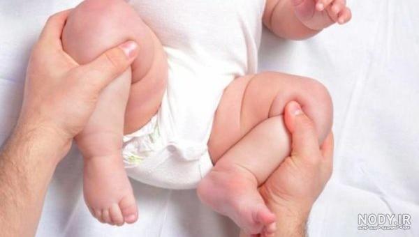 پای پرانتزی در کودکان - شرکت دارویی اکتوورکو