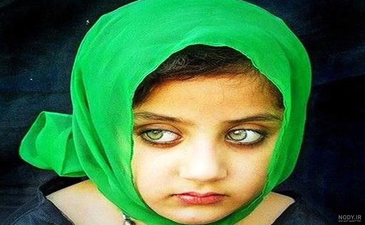 چگونه چشم جنین رنگی می شود؟ رازهایی در مورد رنگ چشم نوزاد چگونه چشم جنین رنگی می شود؟ رازهایی در مورد رنگ چشم نوزاد