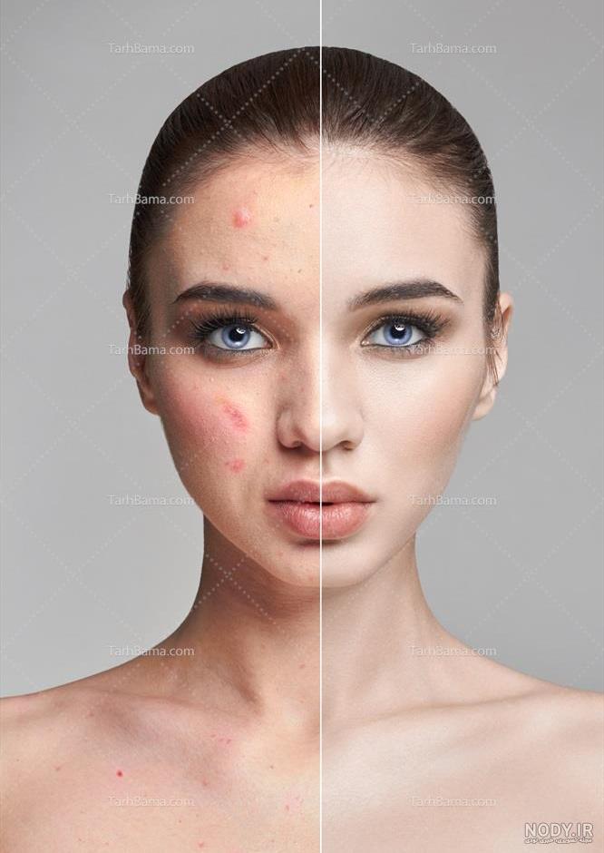 قبل و بعد از تغییر صورت با فتوشاپ! + ویدیو - زیبامون