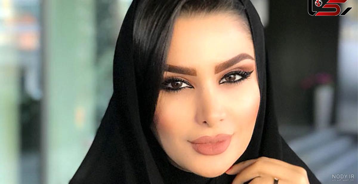 هیکل دنیا جهانبخت قبل از عمل