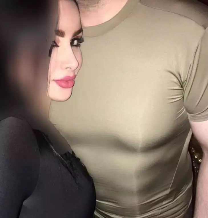 هیکل دنیا جهانبخت قبل از عمل