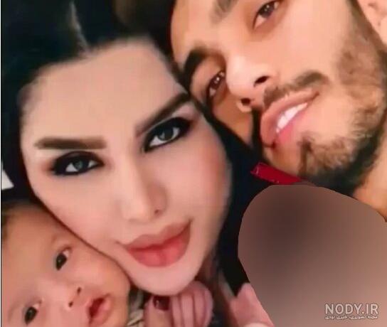 هیکل دنیا جهانبخت قبل از عمل