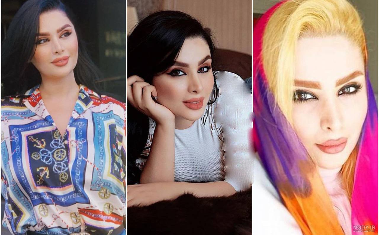 هیکل دنیا جهانبخت قبل از عمل