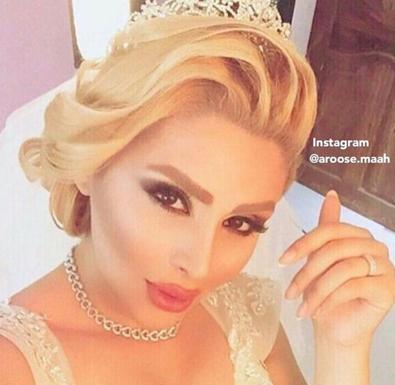 هیکل دنیا جهانبخت قبل از عمل