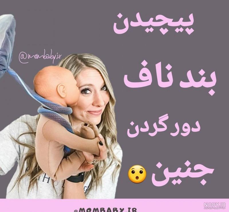بند ناف نوزاد را خودتان ببرید! - کیدمام - مرجع تخصصی حوزه مادر و کودک