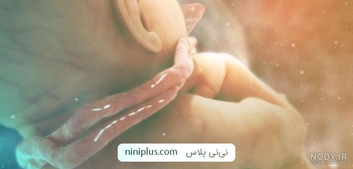 عکس بند ناف دور گردن جنین