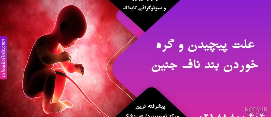 عکس جنین با بند ناف