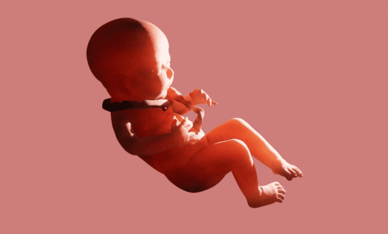 عکس جنین که بند ناف دور گردن