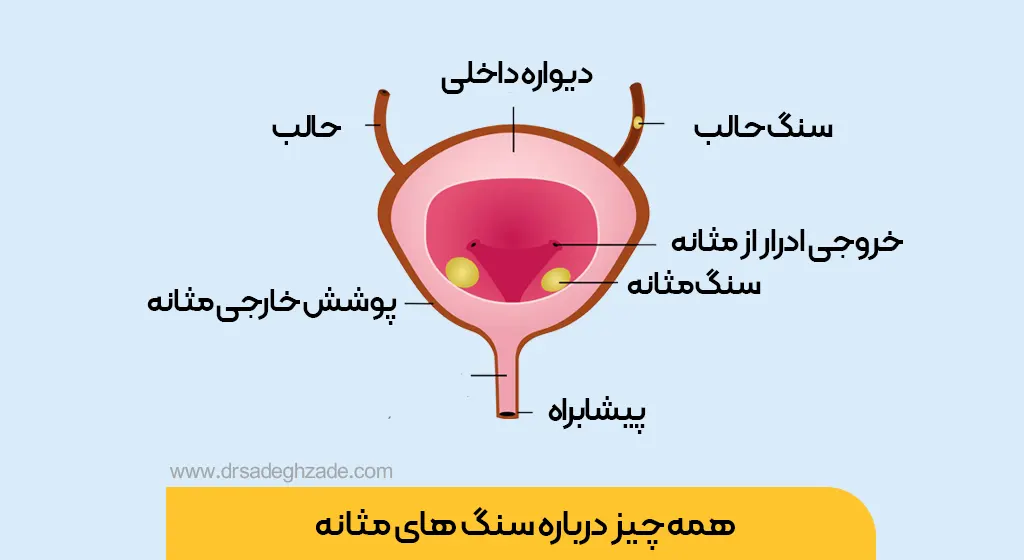 عکس مثانه از بیرون