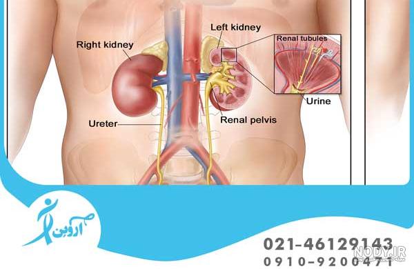 عکس مثانه از بیرون واقعی