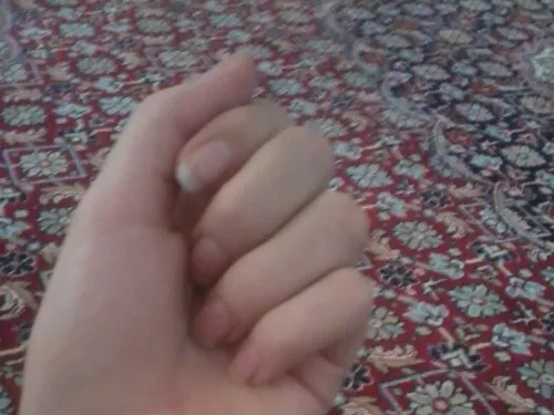 ایتا - زخمِ قلب🫠❤️‍🩹 #دست
