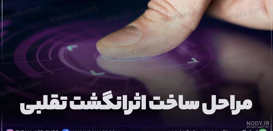 بریدگی کف دست | دست بریده شده با چاقو یا شیشه