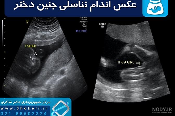تصاویر شگفت انگیز از روند کامل شدن جنین (+عکس)
