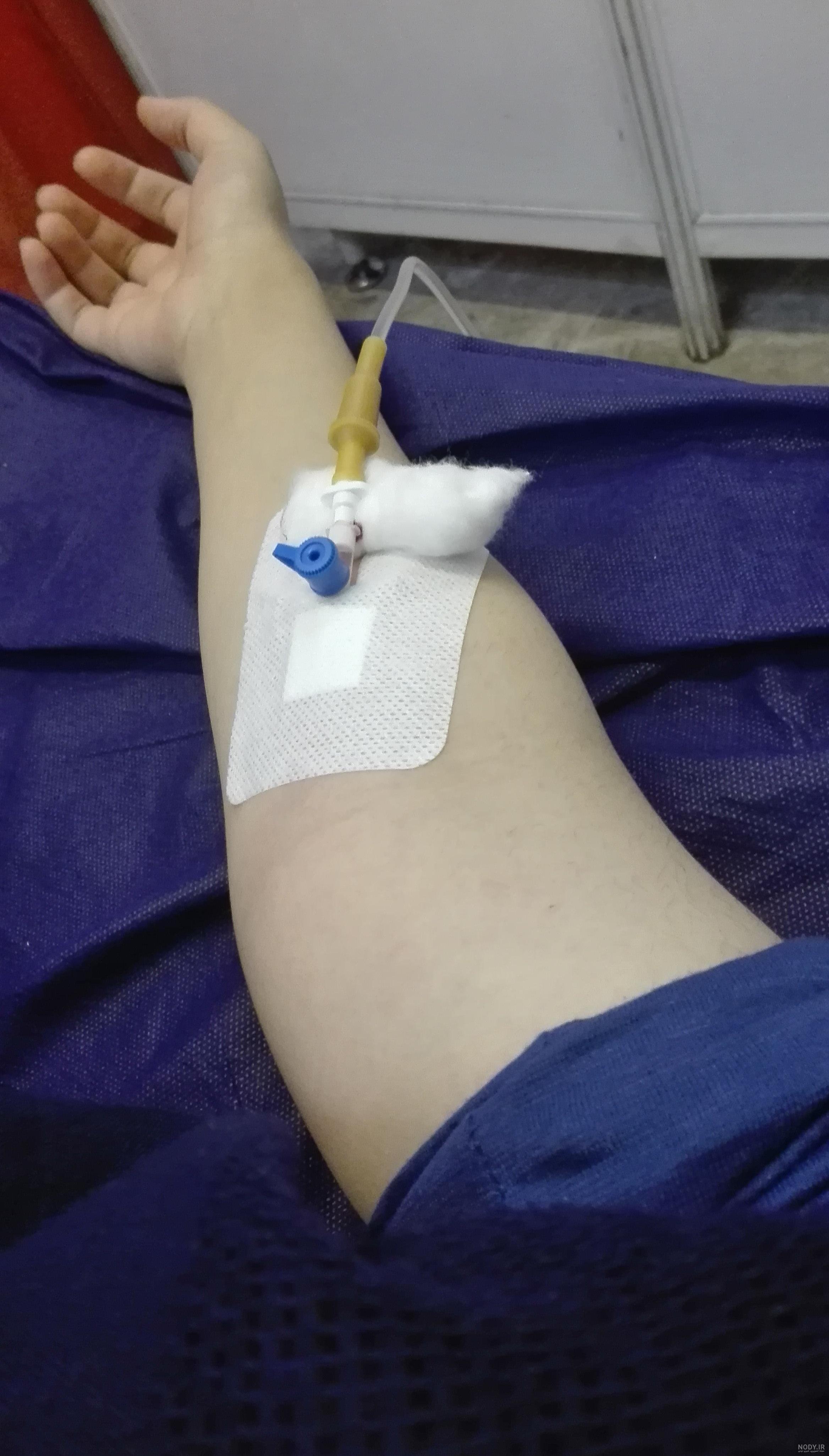 عکس فیک سروم دست دختر