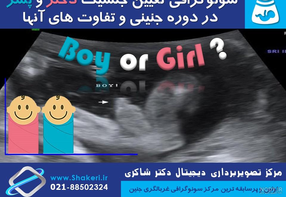 تفسیر آزمایش غربالگری اول