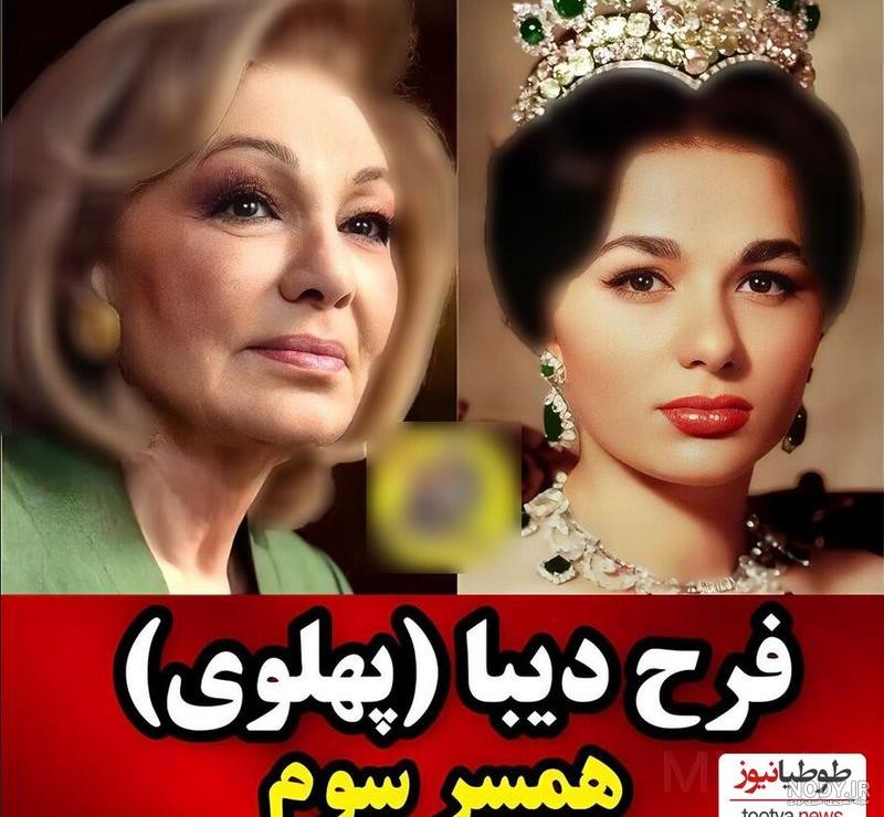 تغییر چهره جالب ژیلا شاهی [+عکس] | پایگاه خبری تحلیلی انصاف نیوز