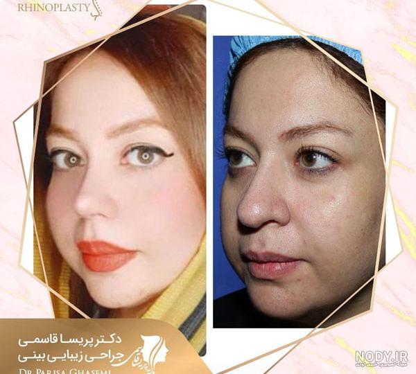 مرگ عکس دختر دماغ عملی خوشگل