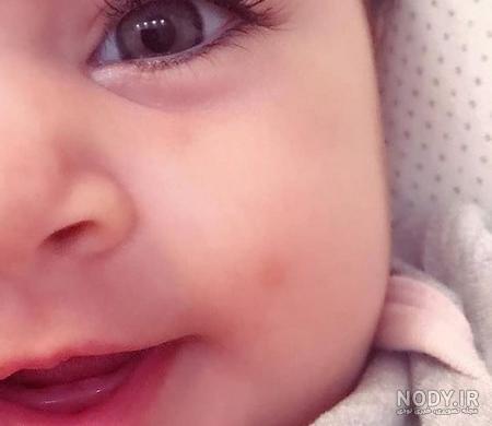 عوامل مؤثر بر رنگ چشم جنین در بارداری عوامل مؤثر بر رنگ چشم جنین در بارداری