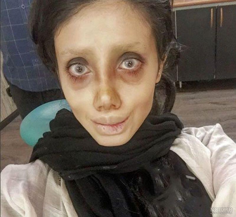 عکس دختر نوزاد زشت