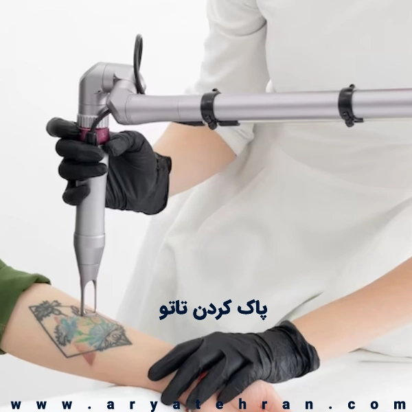 این دستگاه تاتو متعلق به ۲ هزار سال پیش است | گجت نیوز