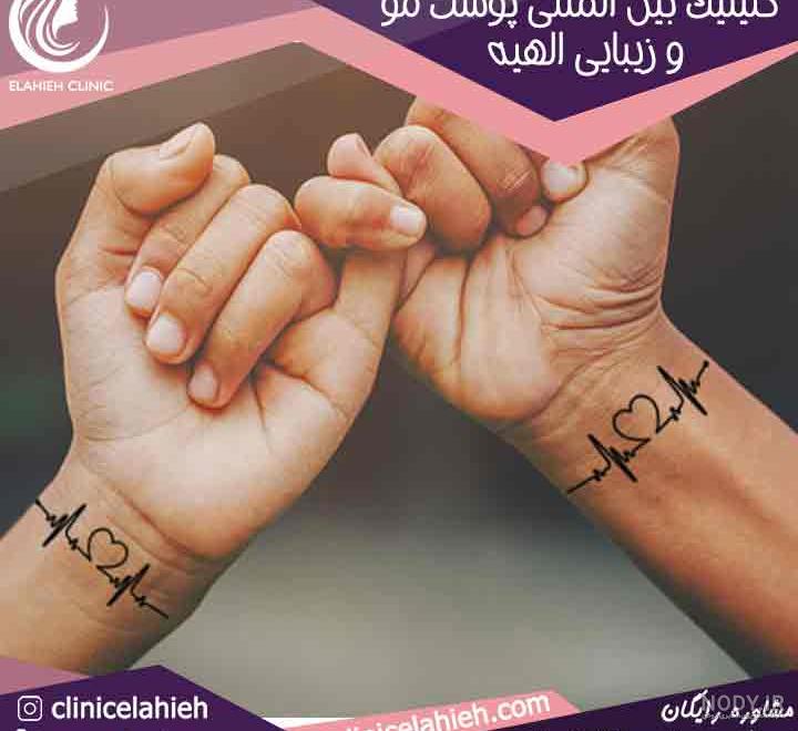 ساق دست طرح تاتو زنانه و مردانه | فروشگاه من و تو خرید