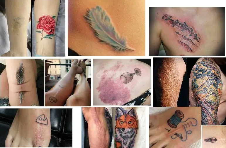 تاتو روی بخیه - تاتو شکم و بدن