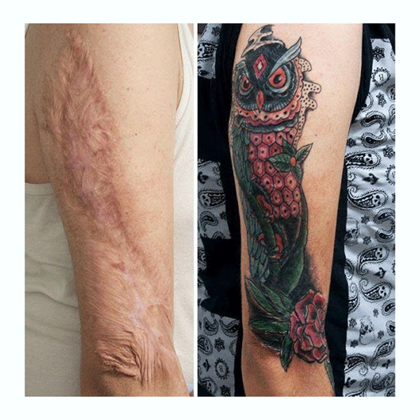 تاتو روی زخم دست - عکس نودی