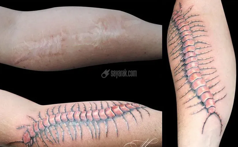 تاتو پزشکی و کاربرد آن برای پوشش جای زخم، سوختگی، میکروپیگمنتیشن صورت و...