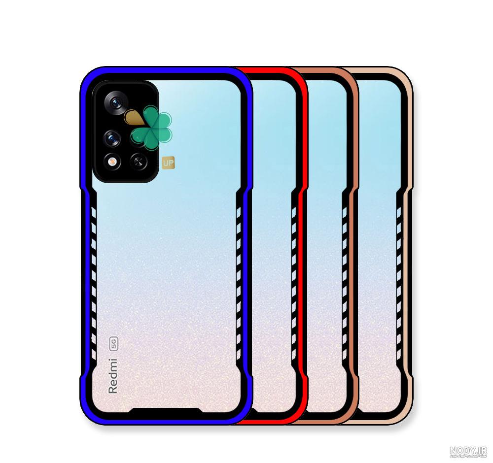 قیمت گوشی نوت 11 پرو پلاس +Xiaomi Redmi Note 11 Pro