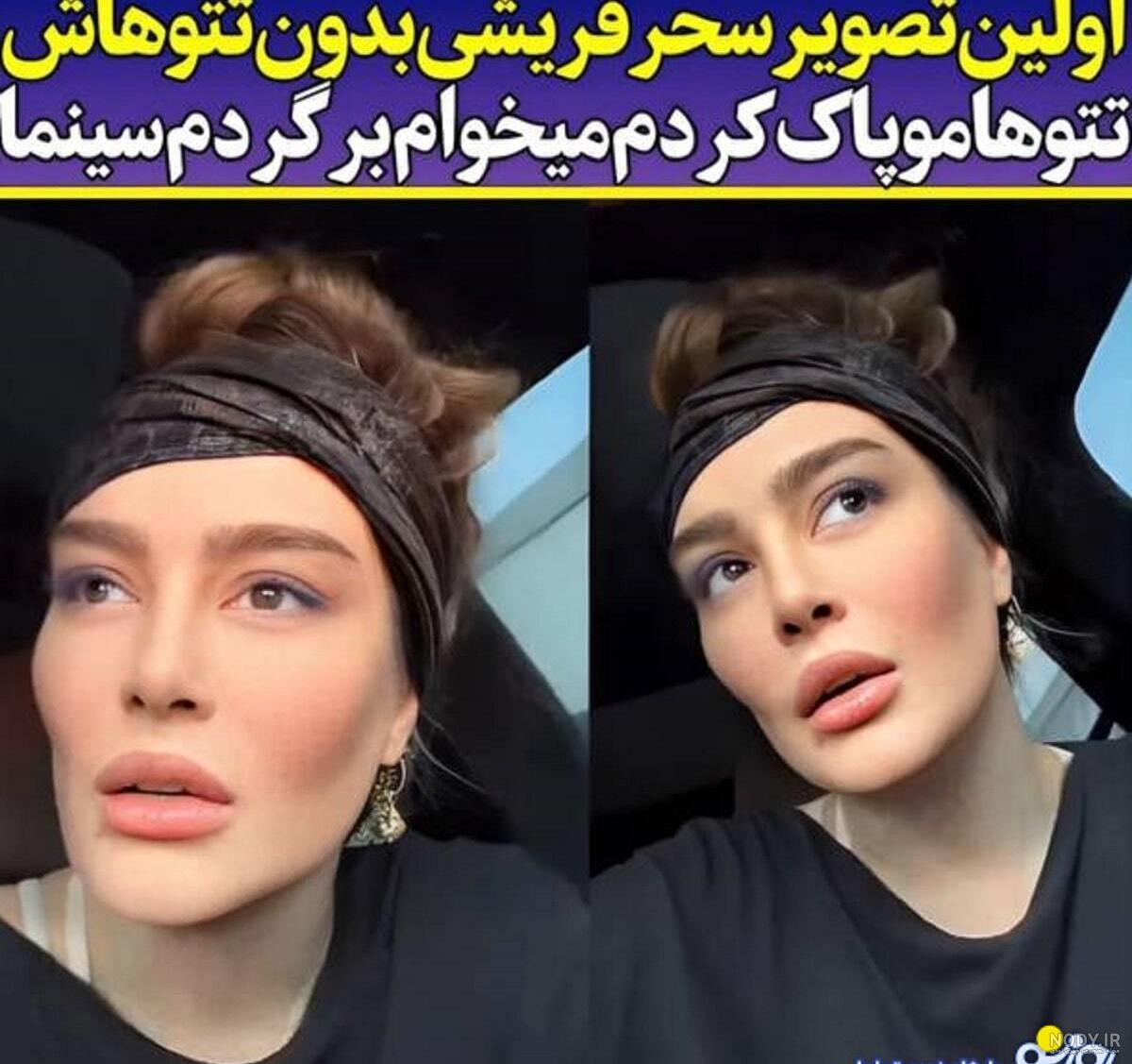 ایا تتوهای تتلو پاک میشود