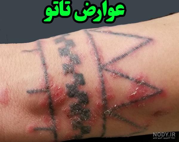 آیا تتو برای پوست ضرر دارد؟ - ملیکا شاپ آیا تتو برای پوست ضرر دارد؟ - ملیکا شاپ