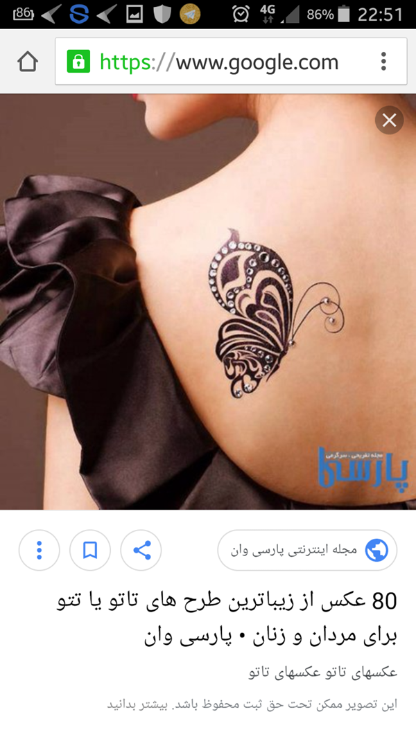 بوتاکس معده چیست | هزینه بوتاکس معده | عوارض بوتاکس معده