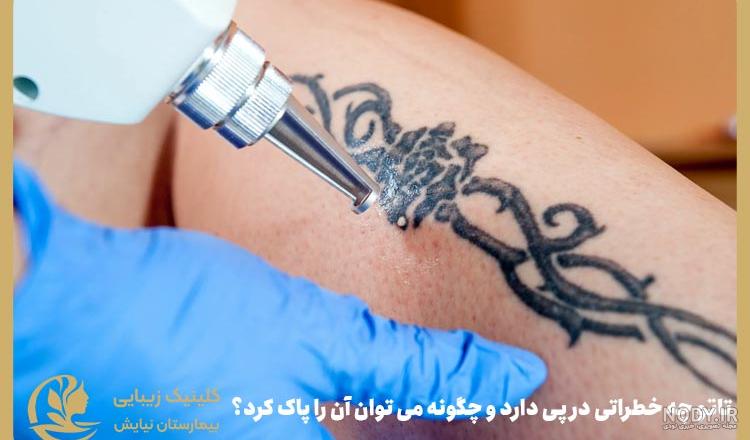 تاتو برای چه کسانی ضرر دارد