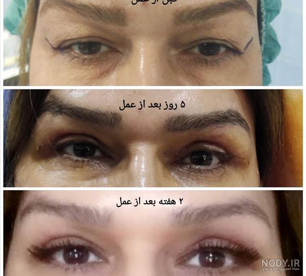 بهترین چشم پزشک اهواز + لیست جراحان متخصص چشم | کار شما