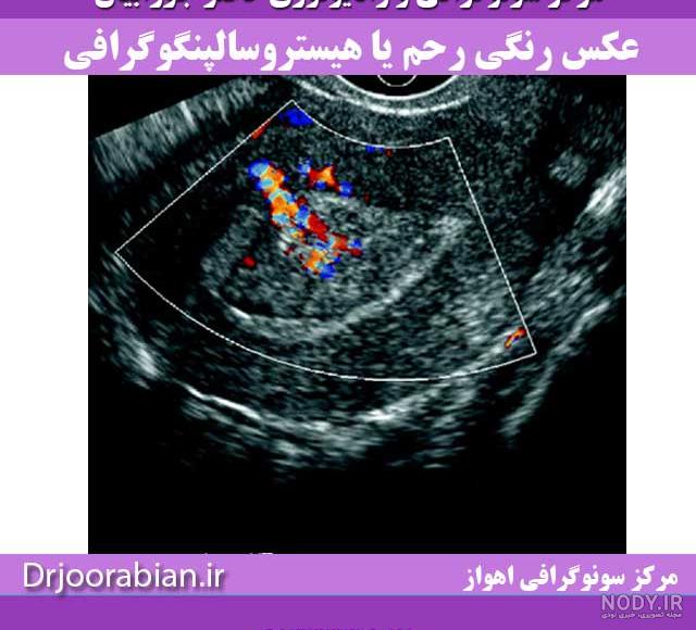 عکس برداری از چشم در اهواز عکس برداری از چشم در اهواز
